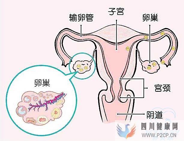 排卵障碍能做试管婴儿吗？成功率多少？(38岁做试管婴儿成功率有多少)(图1)