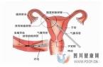 输卵管阻塞何时可以做试管婴儿(女方输卵管堵塞做