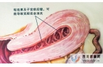 干细胞的4大作用,帮助修复宫腔粘连所致的子宫内