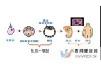 你了解干细胞吗干细胞疗法可以治疗哪些病